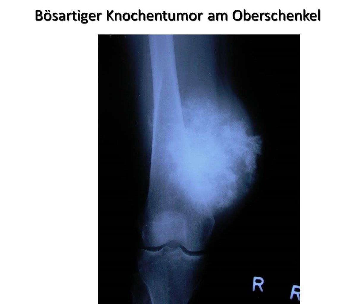 Zentrum für Knochengesundheit Berlin-Brandenburg - Asklepios Klinik ...